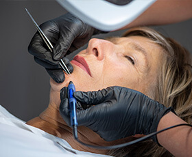 Elektrisch epileren van de kin vrouw