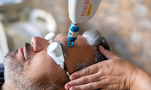 Beauty pixel behandeling voor huidverstrakking van het gelaat