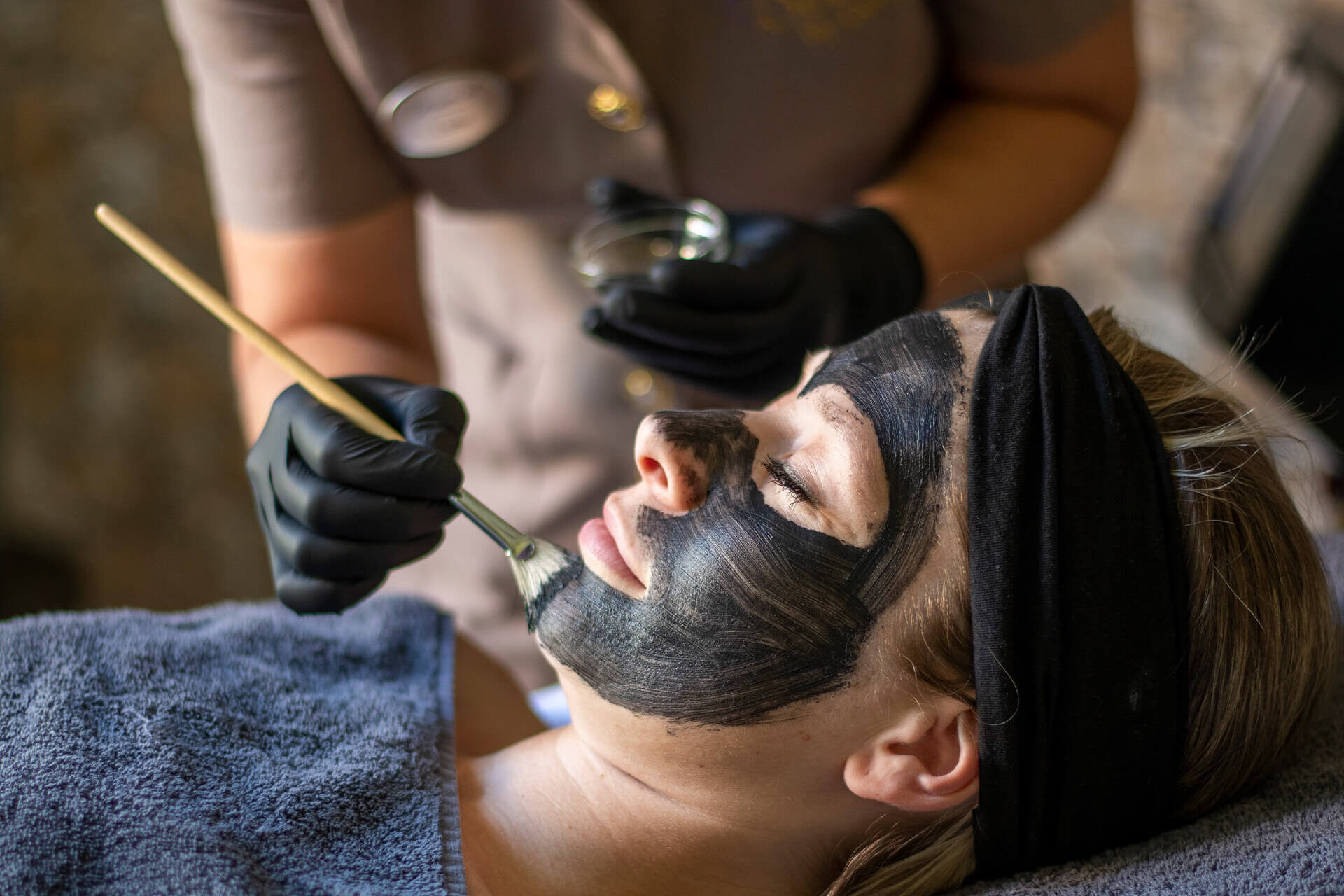 Carbon peeling behandeling voor een diepe peeling voor huidverjonging