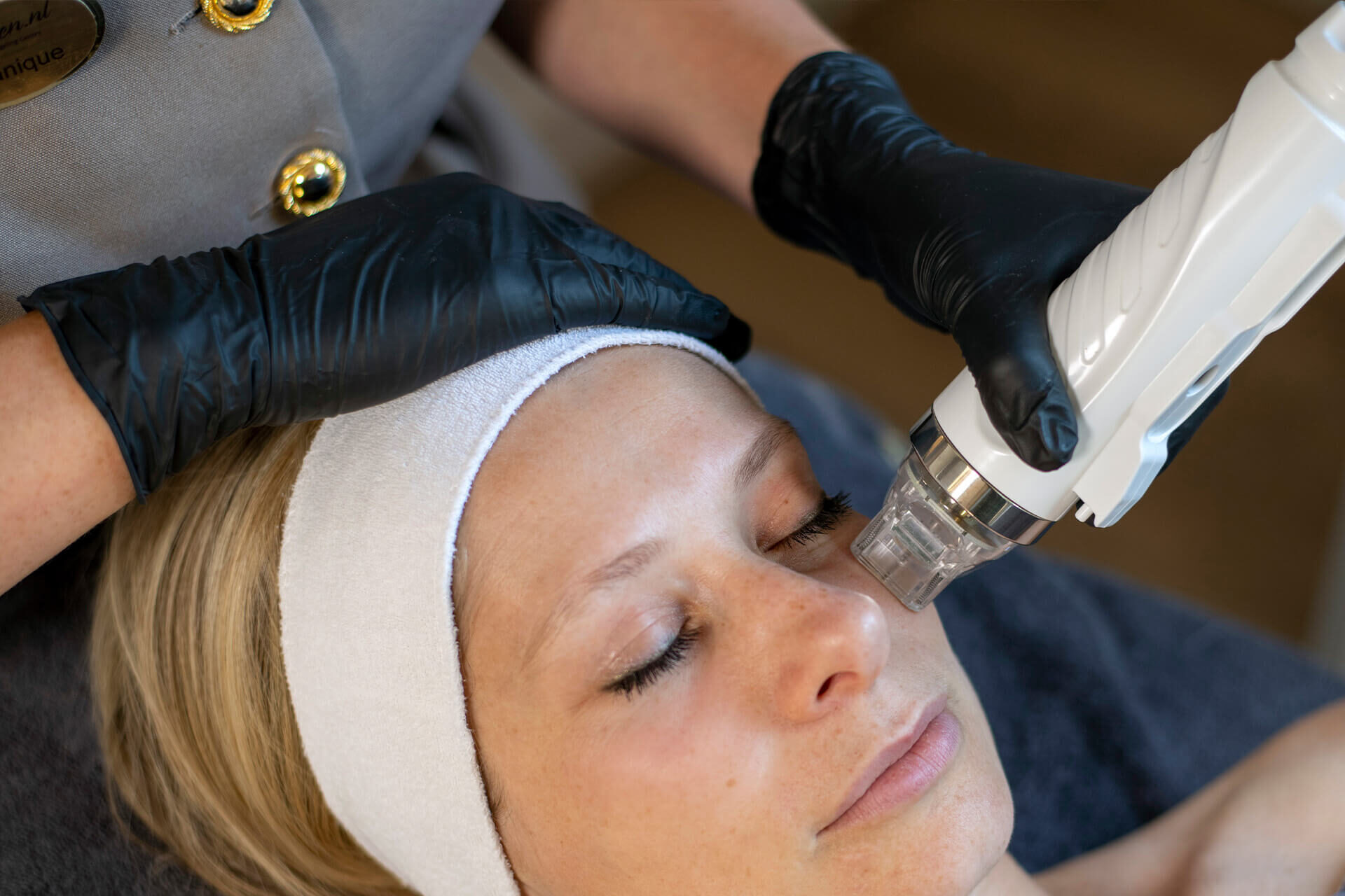 Microneedling RF behandeling om de huid te verstrakken