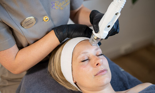 Microneedling RF behandeling om een verslapte huid te verstrakken