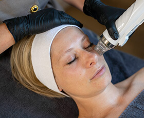 Microneedling RF behandeling om de huid te verstrakken