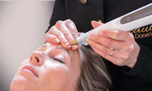 Ooglidcorrectie met plasma lift voor hangende oogleden