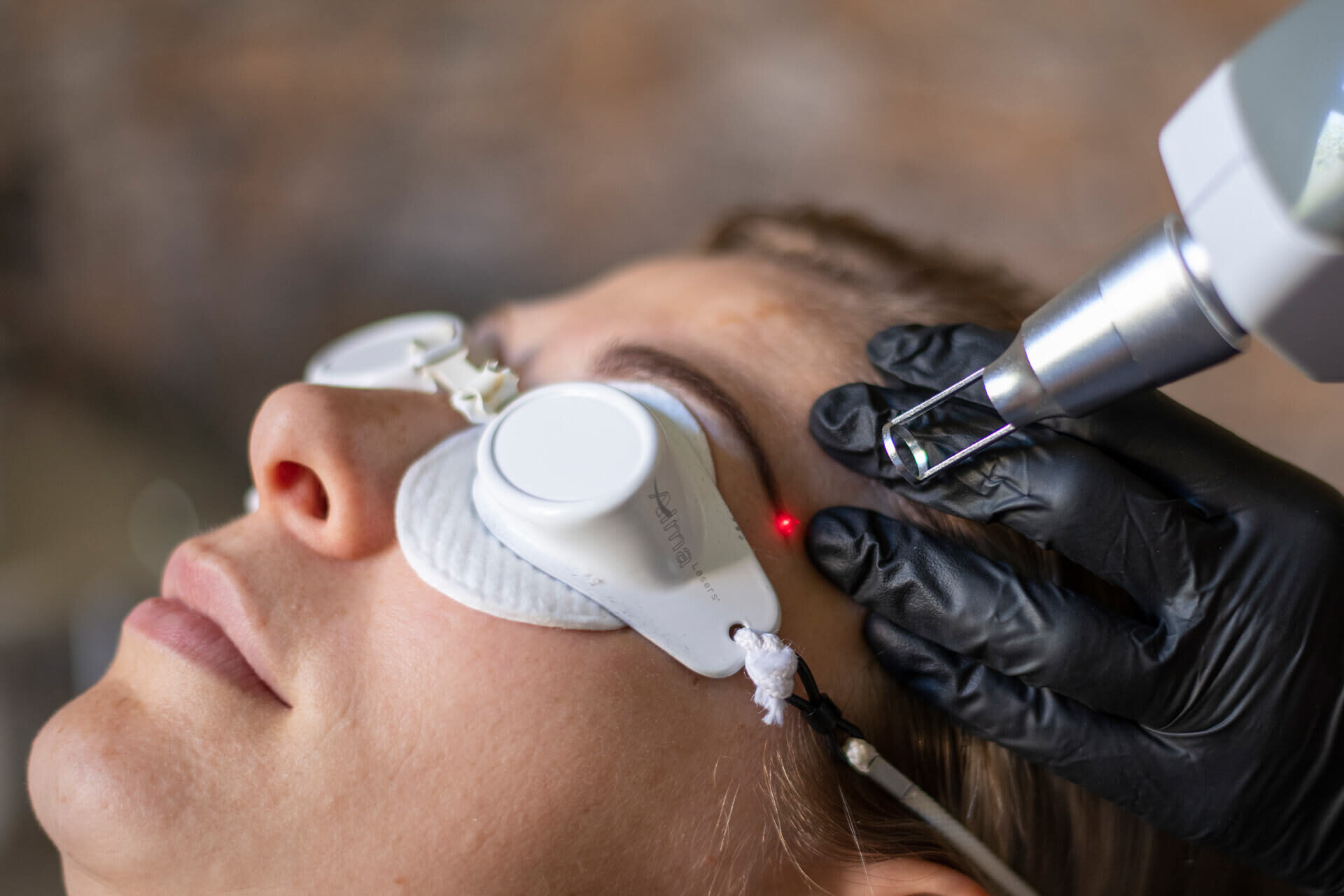 Het verwijderen van permanente make up PMU