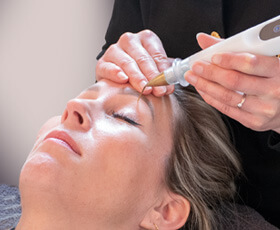 Plasma lift behandeling voor verschillende huidproblemen