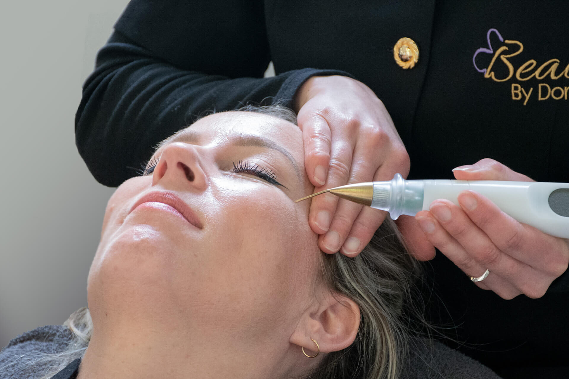 Plasma lift voor het verbeteren van de huid